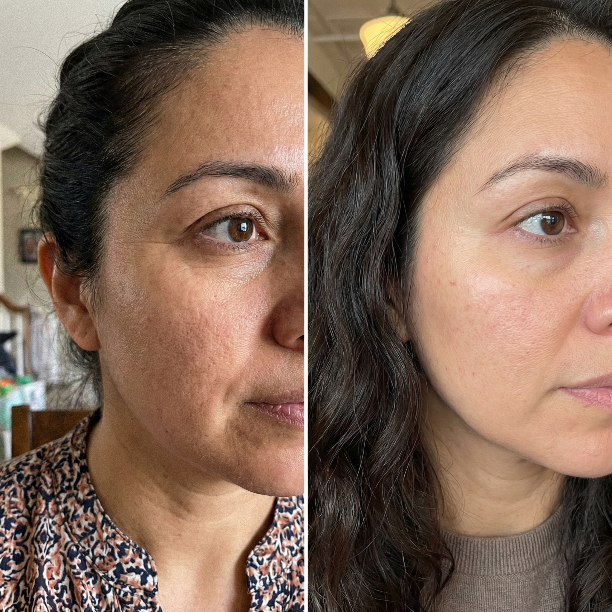 Cuando Las Cremas No Alcanzan: Firmeza Visible Con 30 Péptidos Activos